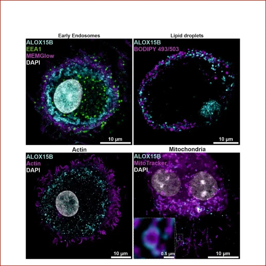 Cellular location of ALOX15B in primary human macrophages