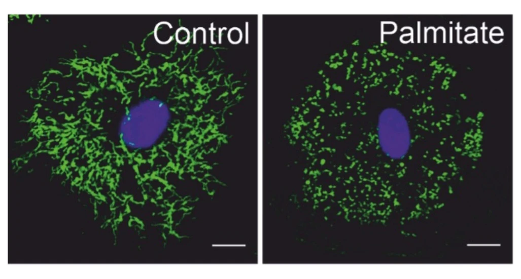 Mitochondrial morphology in primary human macrophages responding to fatty acid palmitate